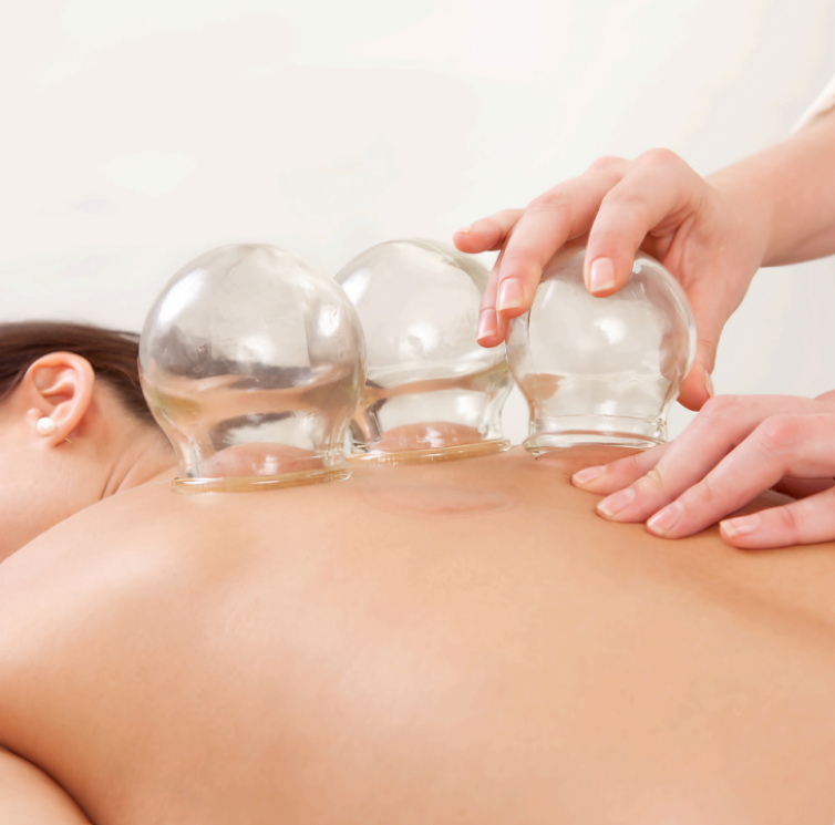TCM Slimming Cupping Therapy