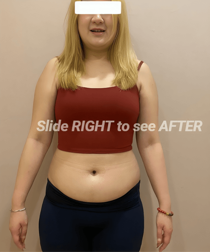 Slide RIGHT to see AFTER 1