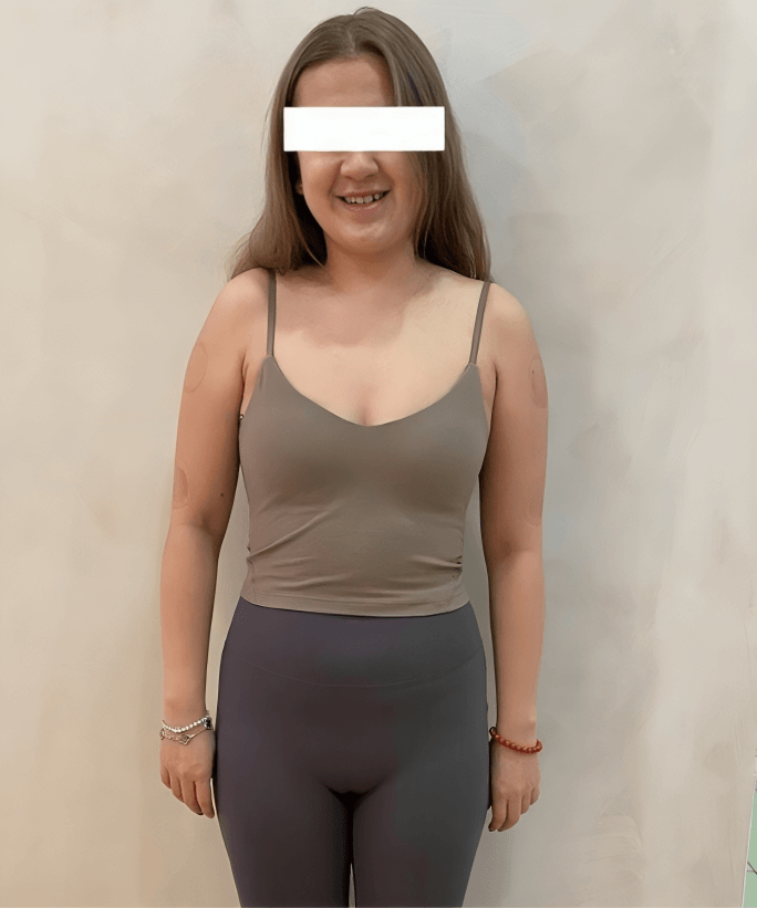 1 (1) Slide RIGHT to see AFTER 2